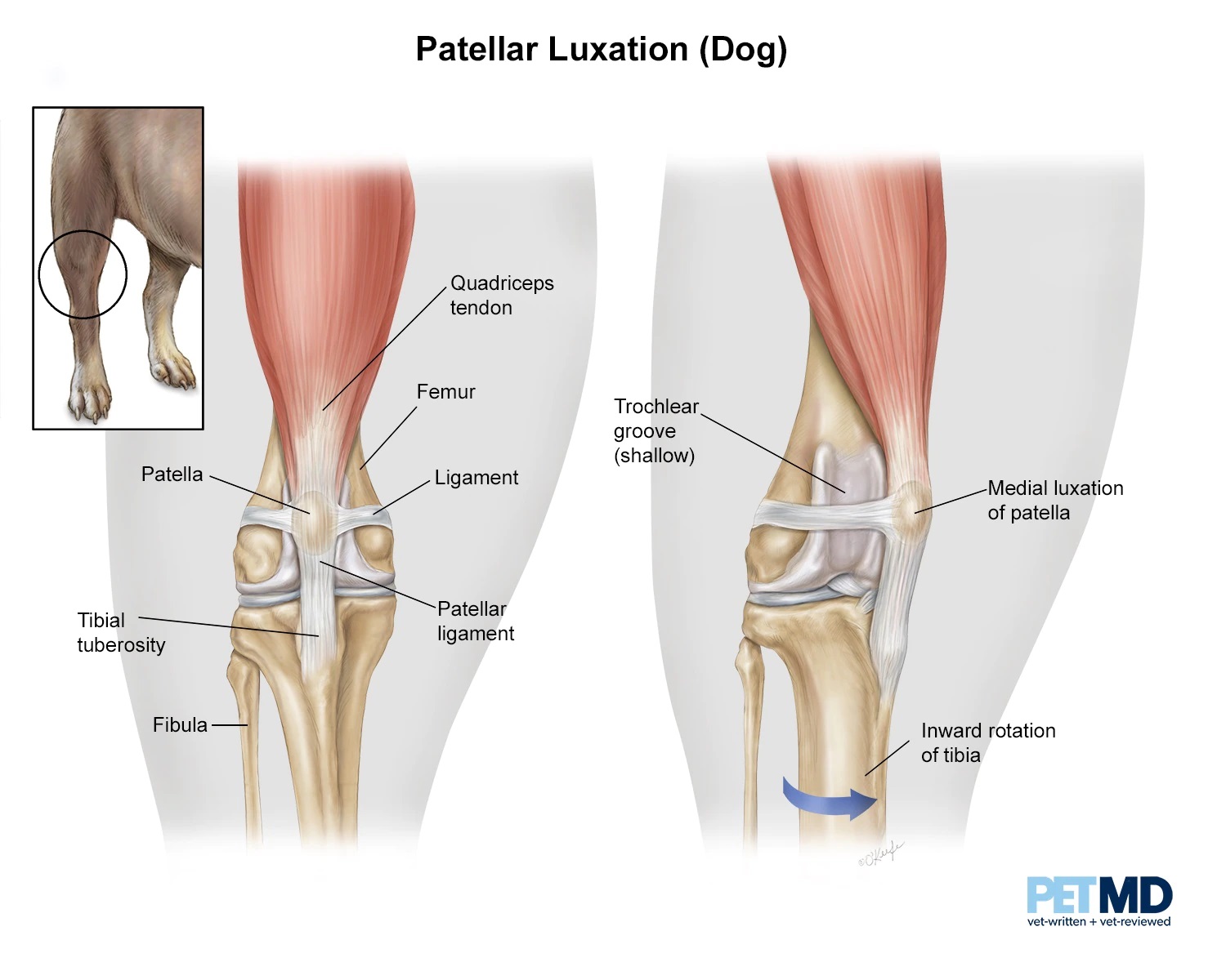 medial luxating patella