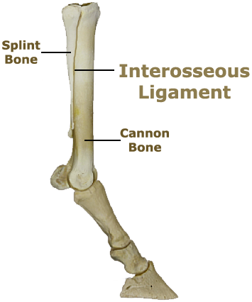inflammation of the ligament