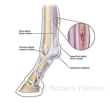 Bowed Tendon Look